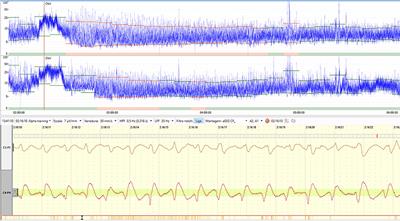 Current Status and Future Directions of Neuromonitoring With Emerging Technologies in Neonatal Care